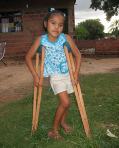 Because of the Extreme Poverty Fund, Noemi was finally able to get help for her dislocated knee. A common medical problem nearly crippled her for life! 
